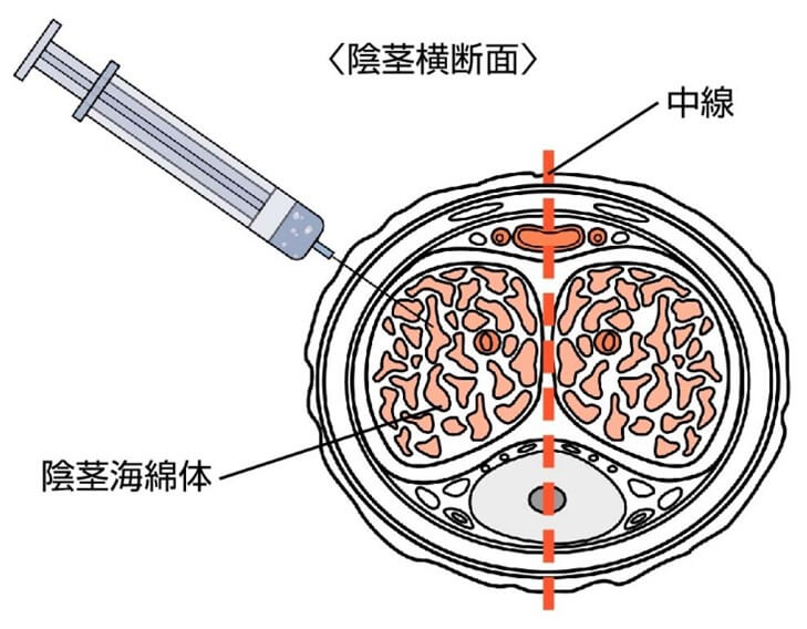 陰茎断面図