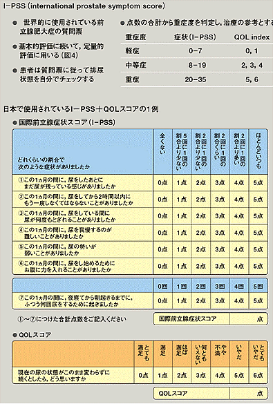 I-PSS＋QOLスコアの一例