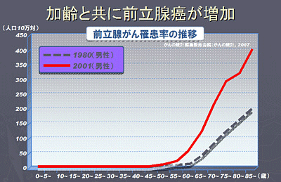 前立腺がん3